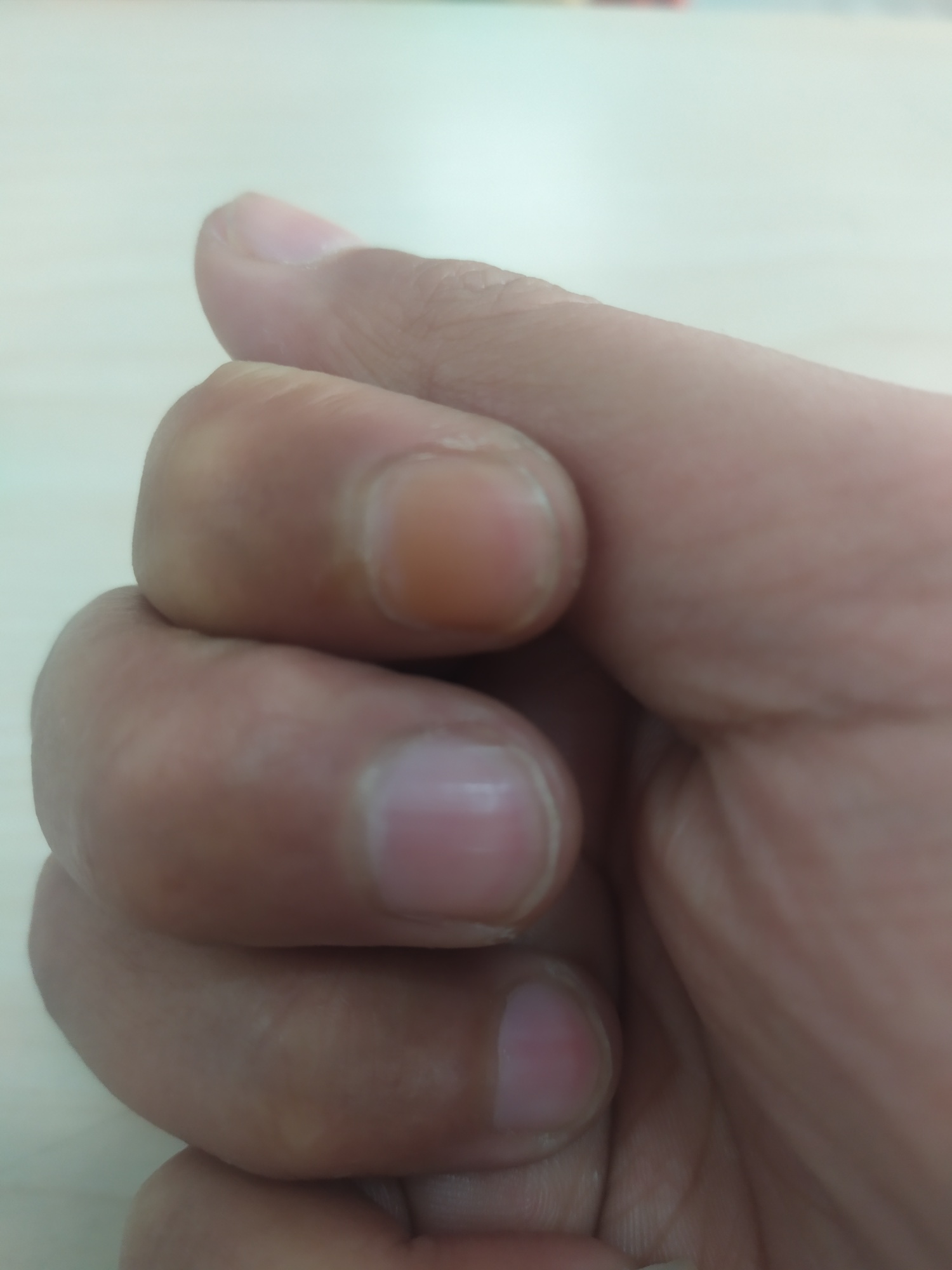 有同款吗指甲都熏黄了