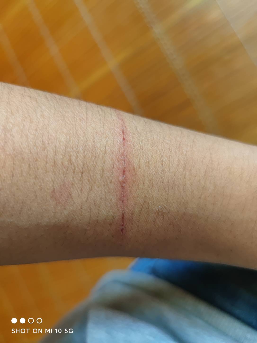 有没有话费毛？10毛就行今晚看比赛

0 / 作者:非诚不勿扰 / 