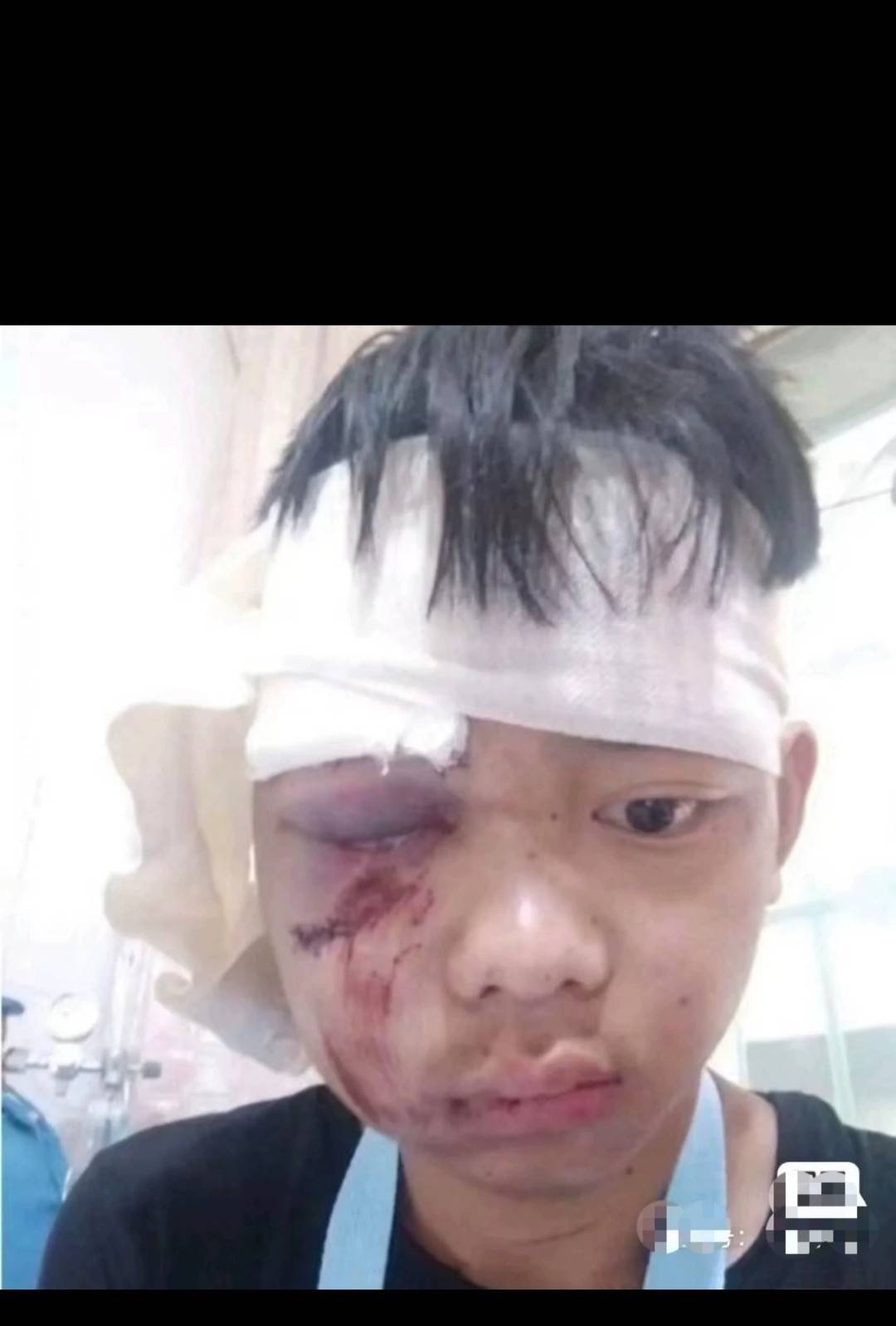 我兄弟不相信ibox呼朋唤友第二轮第三轮明天出，被我打成这样了

35 / 作者:非诚不勿扰 / 