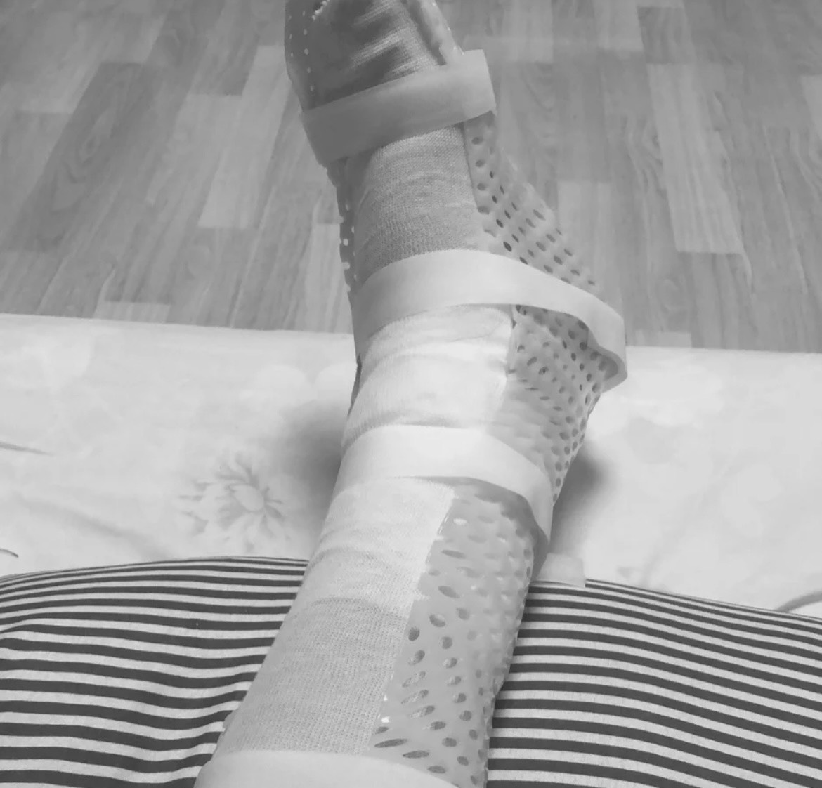 伤着骨头了，有老哥说是民事，他把我的腿脚撞的现在已经肿的跟猪蹄一样


72 / 作者:杨涵哈哈哈哈 / 