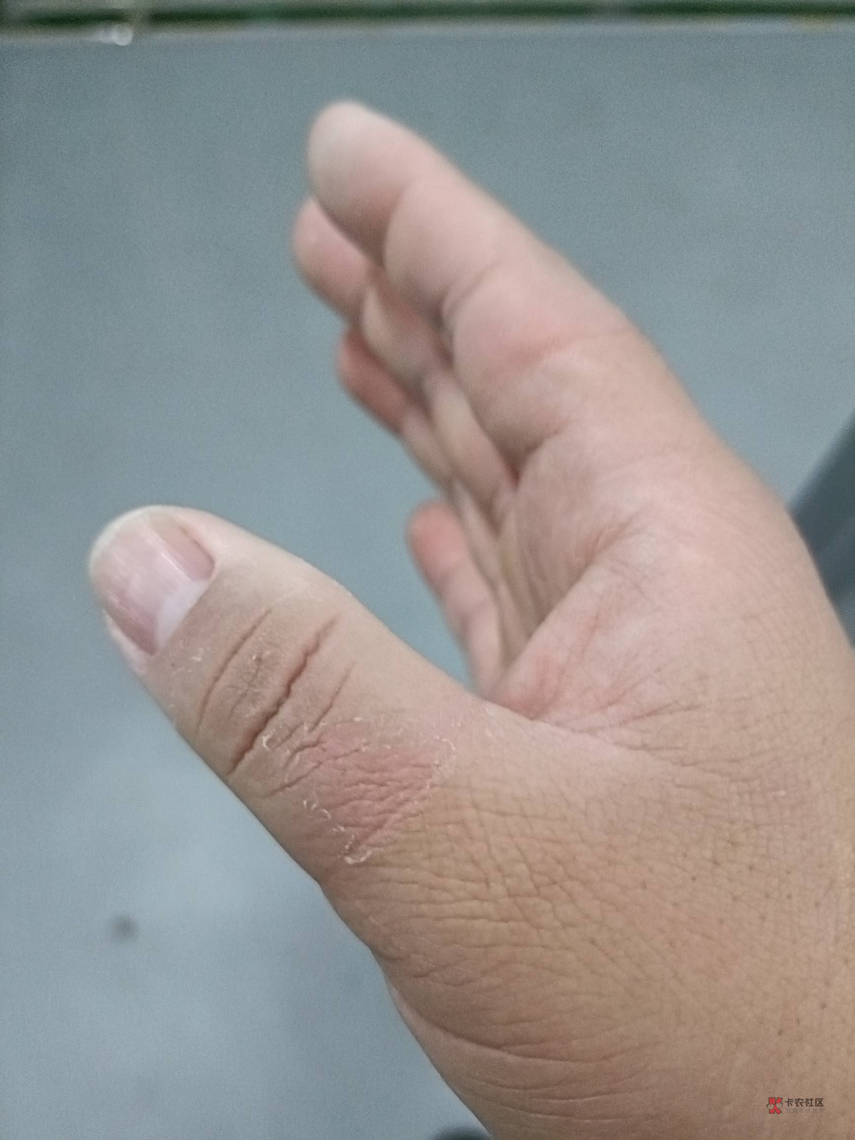 进厂半个月了，一共才上了154小时，让我双休，今天打螺丝手又肿了，那小领导来的第一36 / 作者:宁波躺平老哥 / 