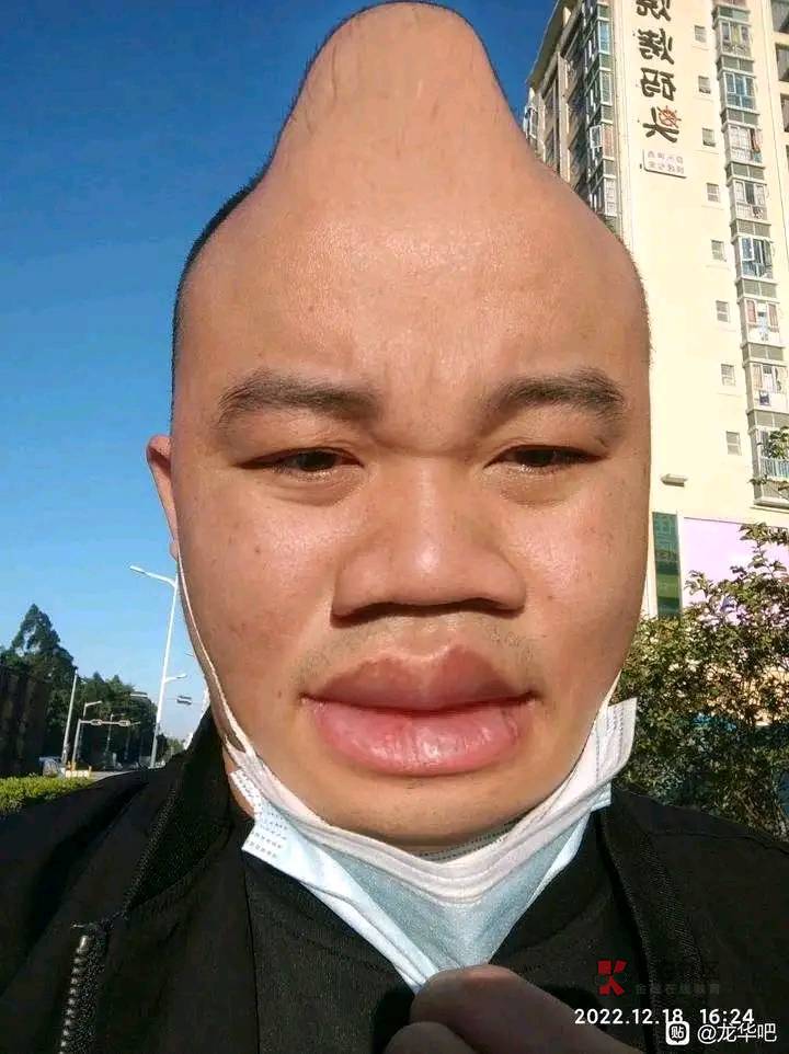 我靠是不是阳了，双腿不舒服，头晕还有点发烧

28 / 作者:痛苦中 / 