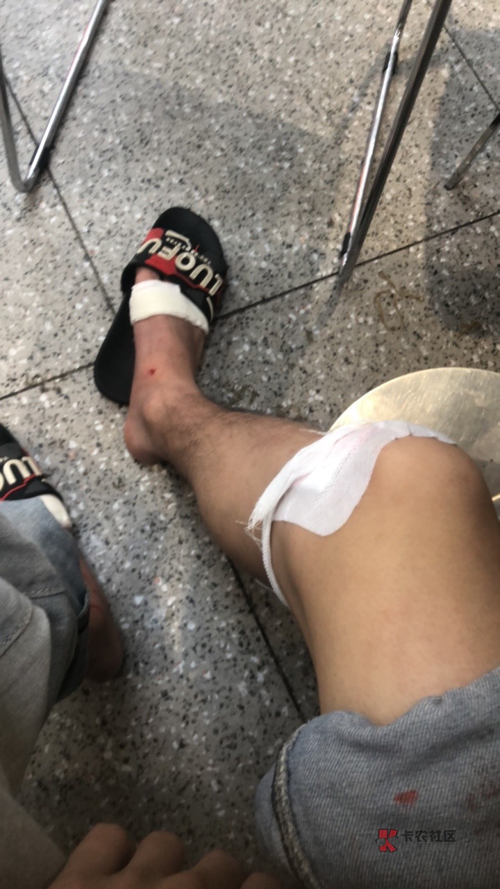 老哥们在青海的来个码，刚刚出去买饭骑电动车摔了，饭钱全部买药了，只能撸养老金了

71 / 作者:吹吹吹风 / 