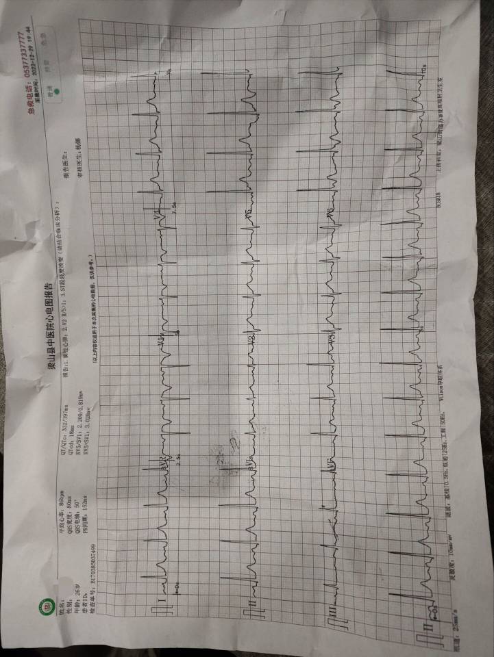 万能的老哥们给看看心电图有问题吗，看不懂

31 / 作者:未来的任务 / 