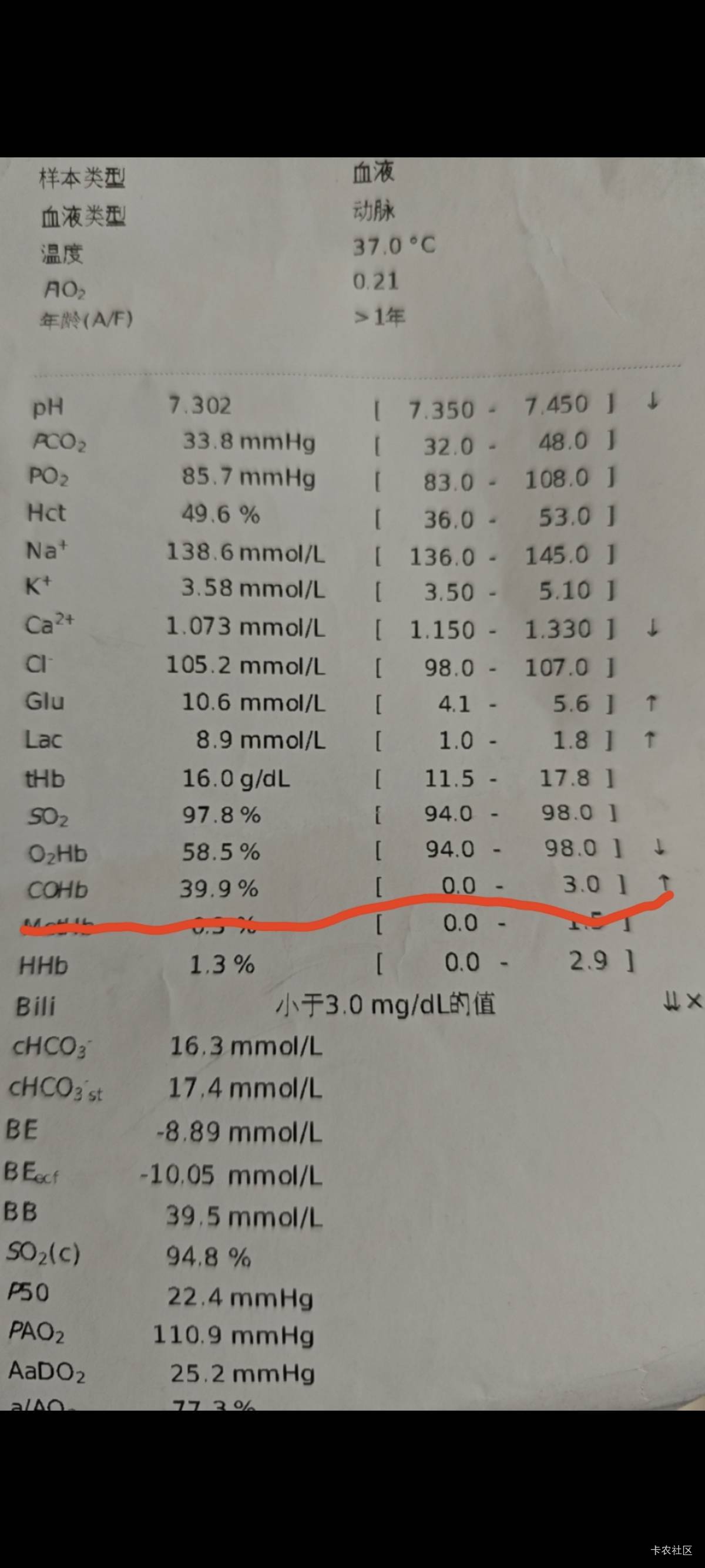 上次差点重新开始了

89 / 作者:未来负翁 / 