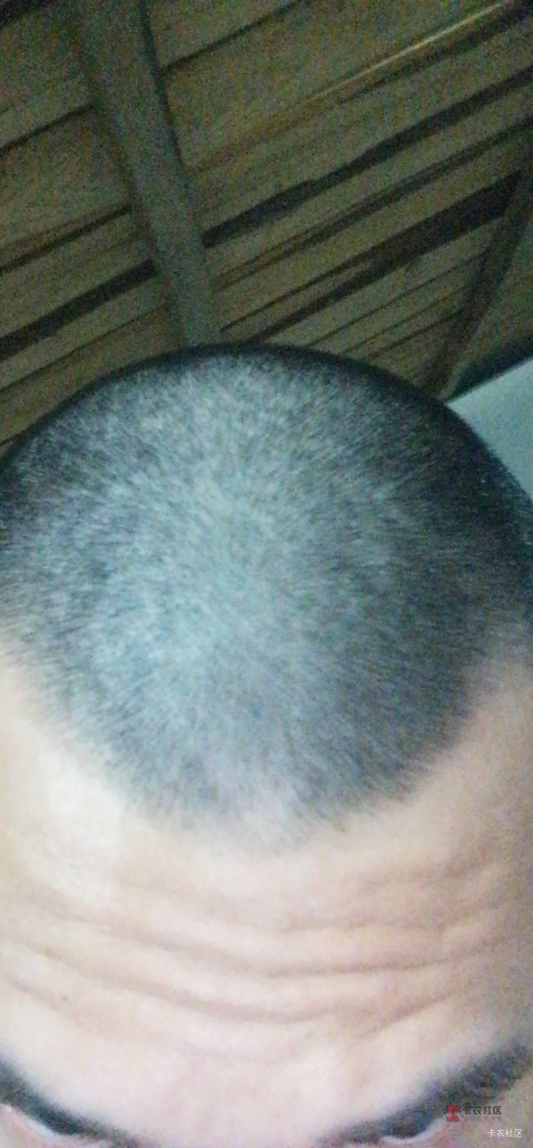 买了个剃头机自己剃了两回感觉还不错。以后就自己剃了不用去外面剃头了美滋滋。

72 / 作者:桃园三坑刘阿满 / 