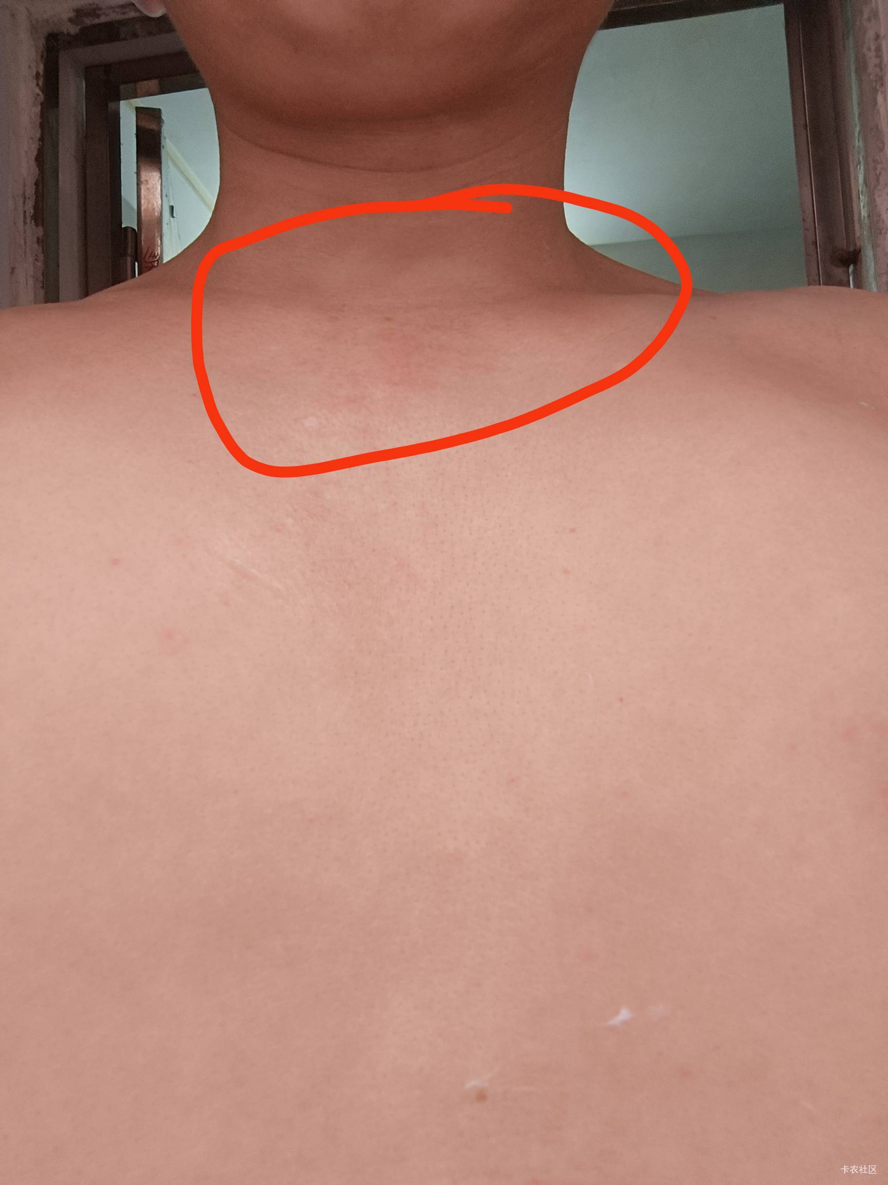 皮肤好痒  这几年都是这样  天气转热就这样  这是湿气重吗？  我怕越轮越多？

8 / 作者:开弓没有回头箭 / 
