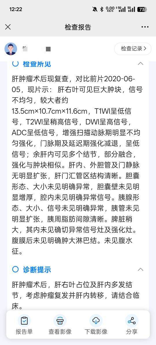 老哥们，那么大的癌，是不是可以出院回家等死了

7 / 作者:溯mh / 