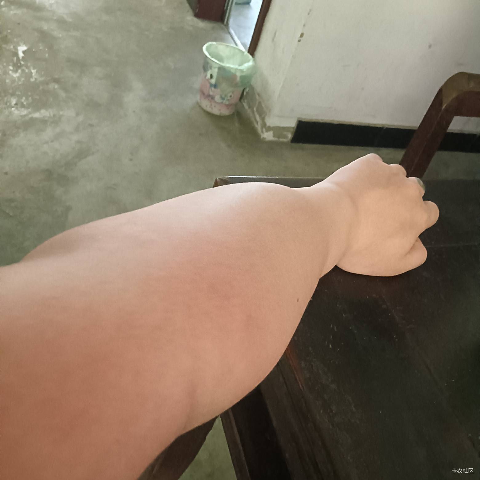 卡农就不能有个正经人吗 说一下用什么办法消肿 这真正是麒麟臂了


74 / 作者:那可不一定 / 
