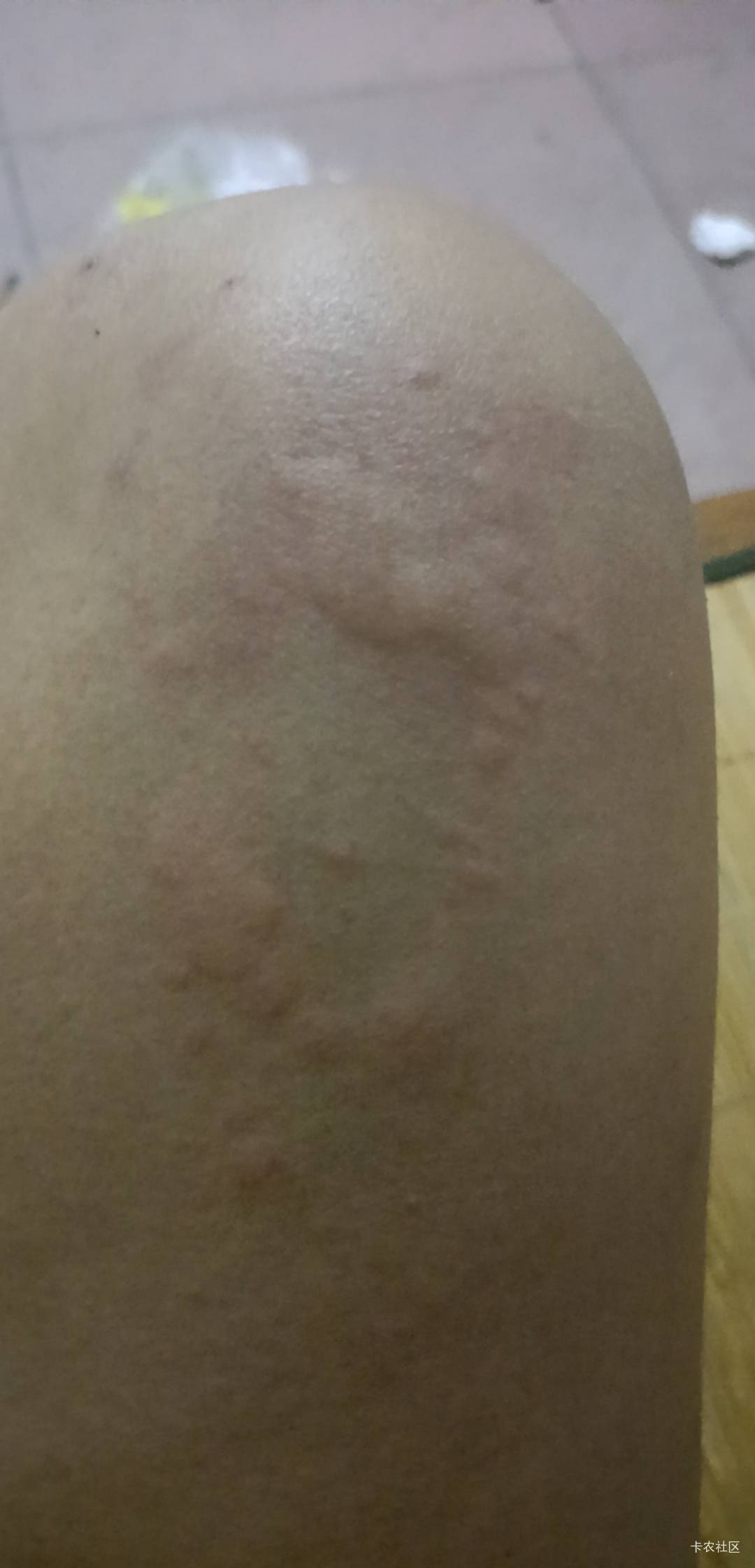 广州热的一批，刚睡几个小时，热都热醒，受不了
43 / 作者:黑狗滚出中国 / 
