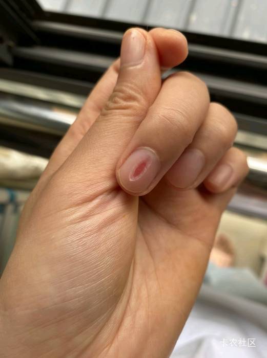 老哥，这种咋子搞

49 / 作者:弱水只取一瓢饮 / 
