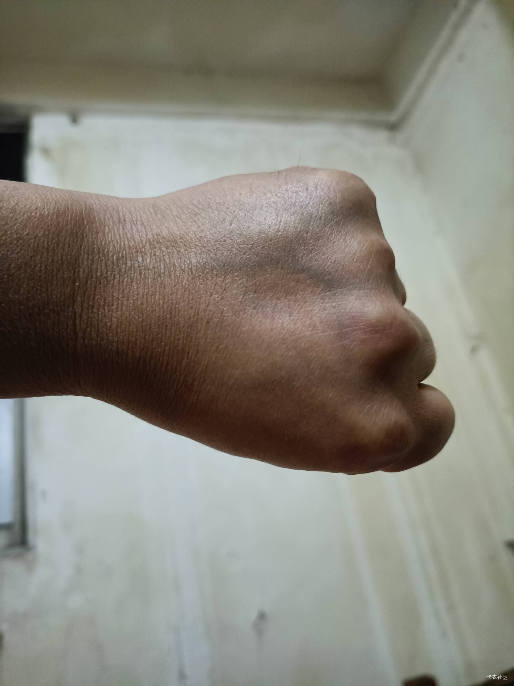 卡农标识！老哥们看看你们的拳头标不标准

93 / 作者:舔歪了 / 