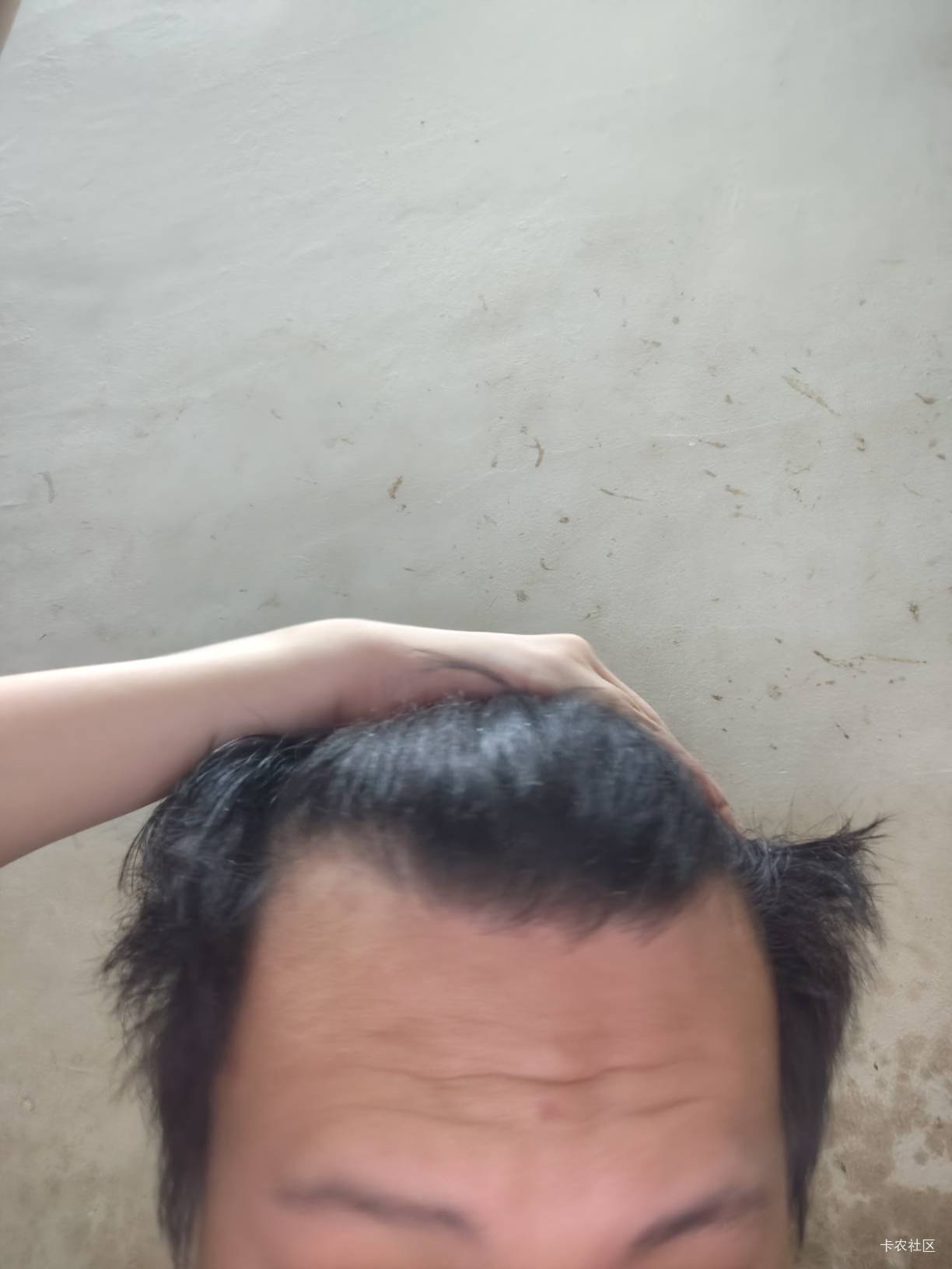 我真不能熬夜了，头发都掉完了，睡觉了

84 / 作者:女貌郎才 / 