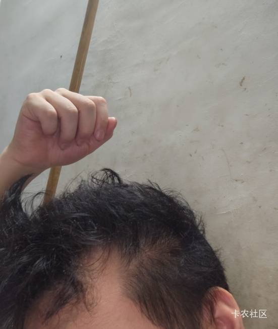 我真不能熬夜了，头发都掉完了，睡觉了

5 / 作者:女貌郎才 / 