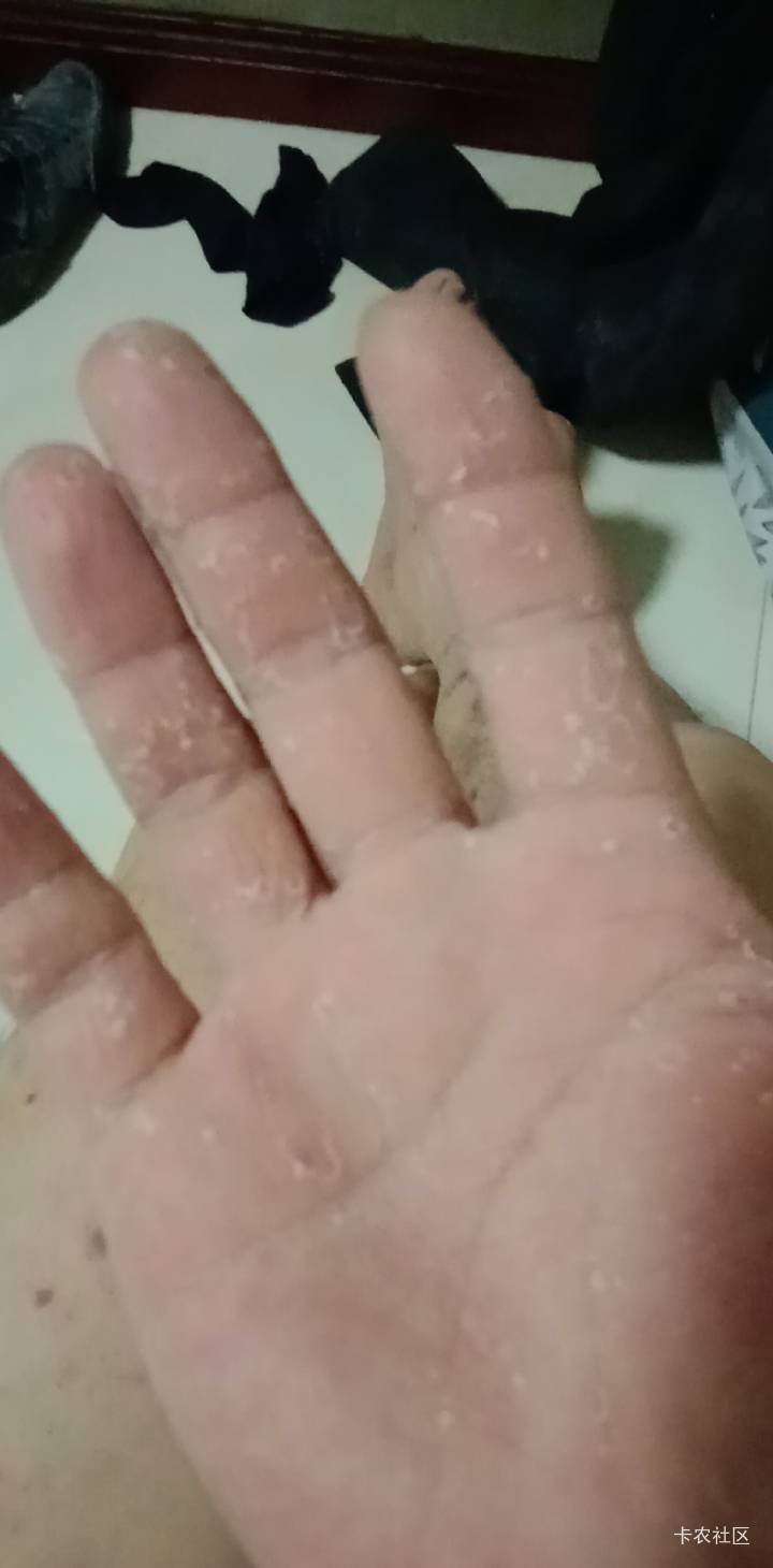 老哥们，我是不是快挂壁了？不是没钱的挂壁，是没命的挂壁。


99 / 作者:mmmmkbh / 