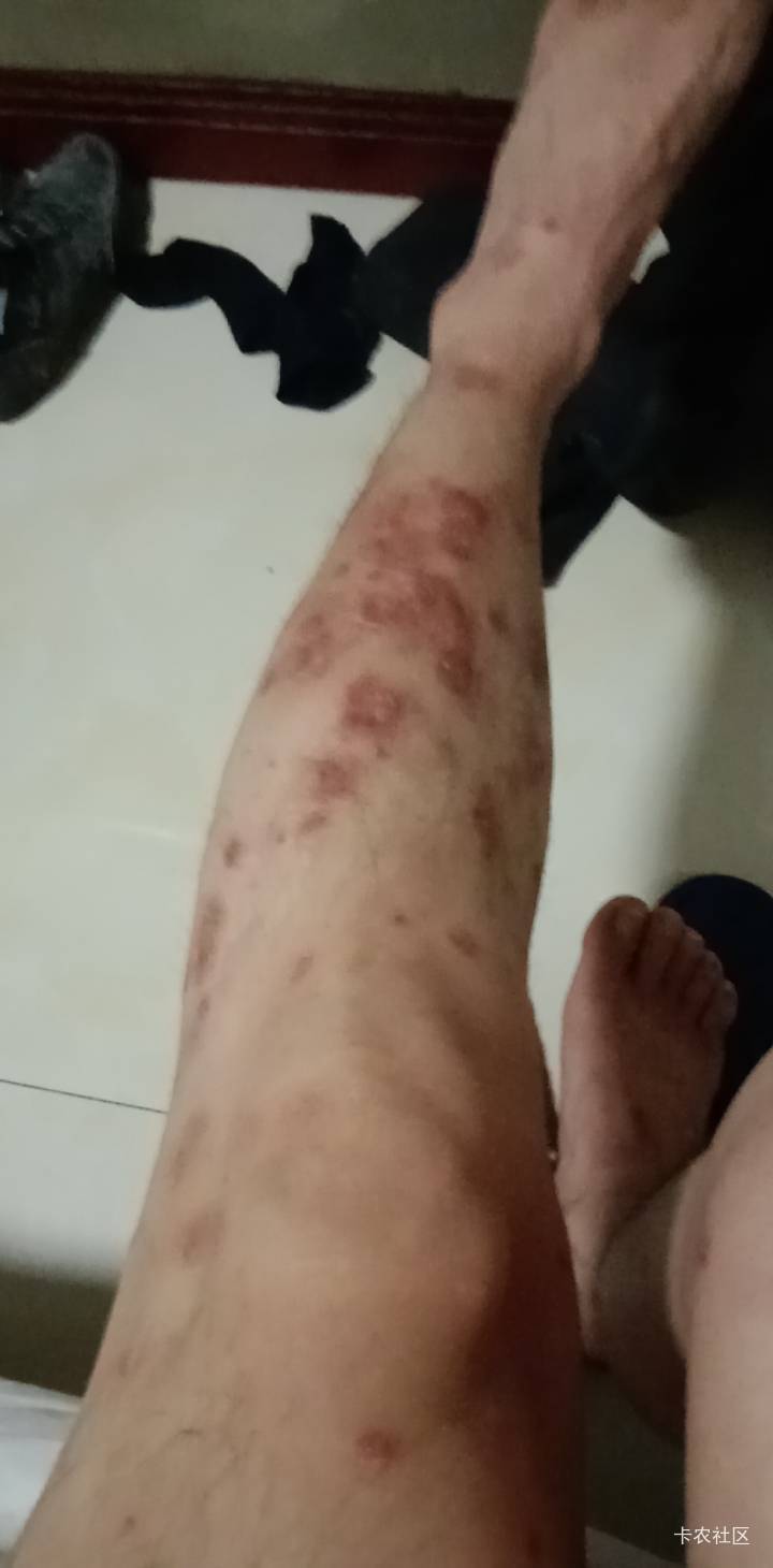 老哥们，我是不是快挂壁了？不是没钱的挂壁，是没命的挂壁。


74 / 作者:mmmmkbh / 