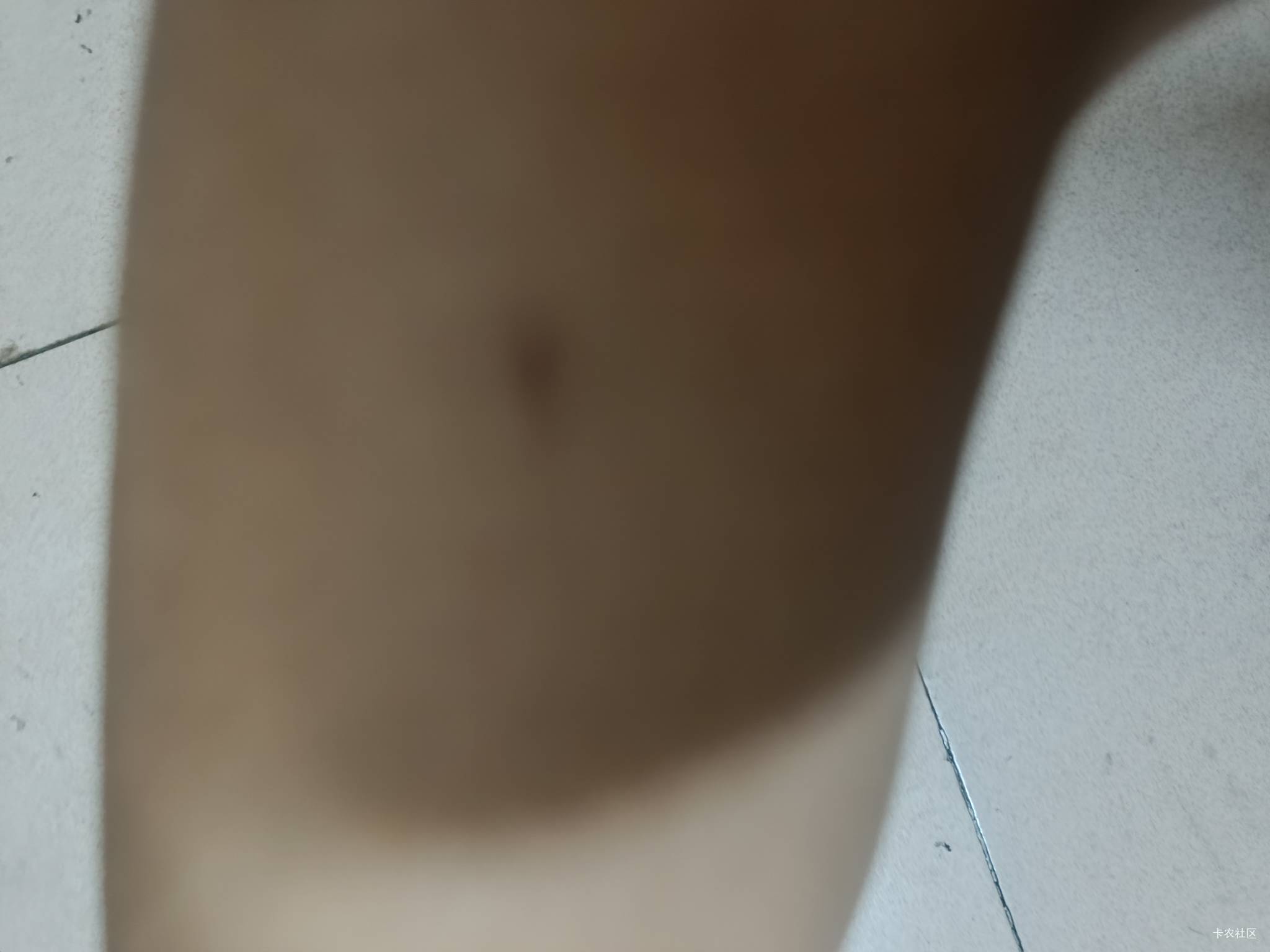 无缘无故哪里来的伤口？


44 / 作者:开弓没有回头箭 / 