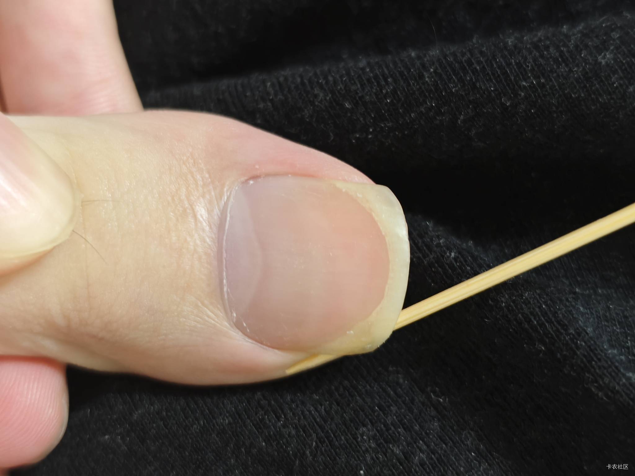 脚趾甲你们怎么剪的，太长了我又不敢剪怕得甲沟炎啥的，今天走了一天路现在一直痛

99 / 作者:暖风归去 / 