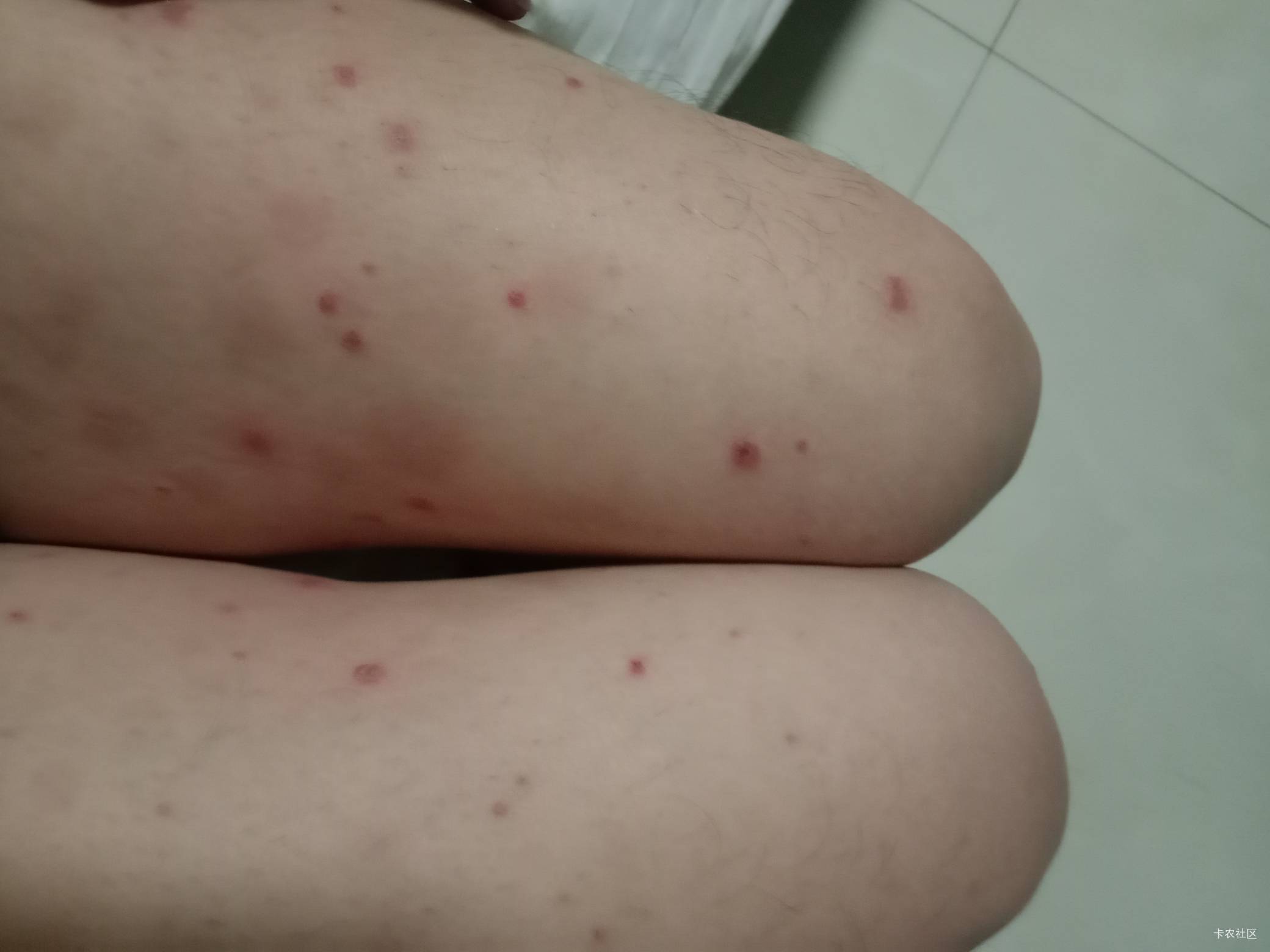 老哥们，我真没有乱搞，至今仍是童子。就感冒了半个月，输了几次液，就成这样了。今天18 / 作者:mmmmkbh / 