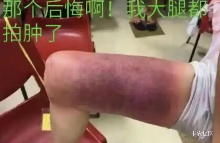 几年前的ib才是神话，当时吃到的都是立马上岸，可惜我当时胆子小，赚了一点就跑了

49 / 作者:广鸡周某人 / 