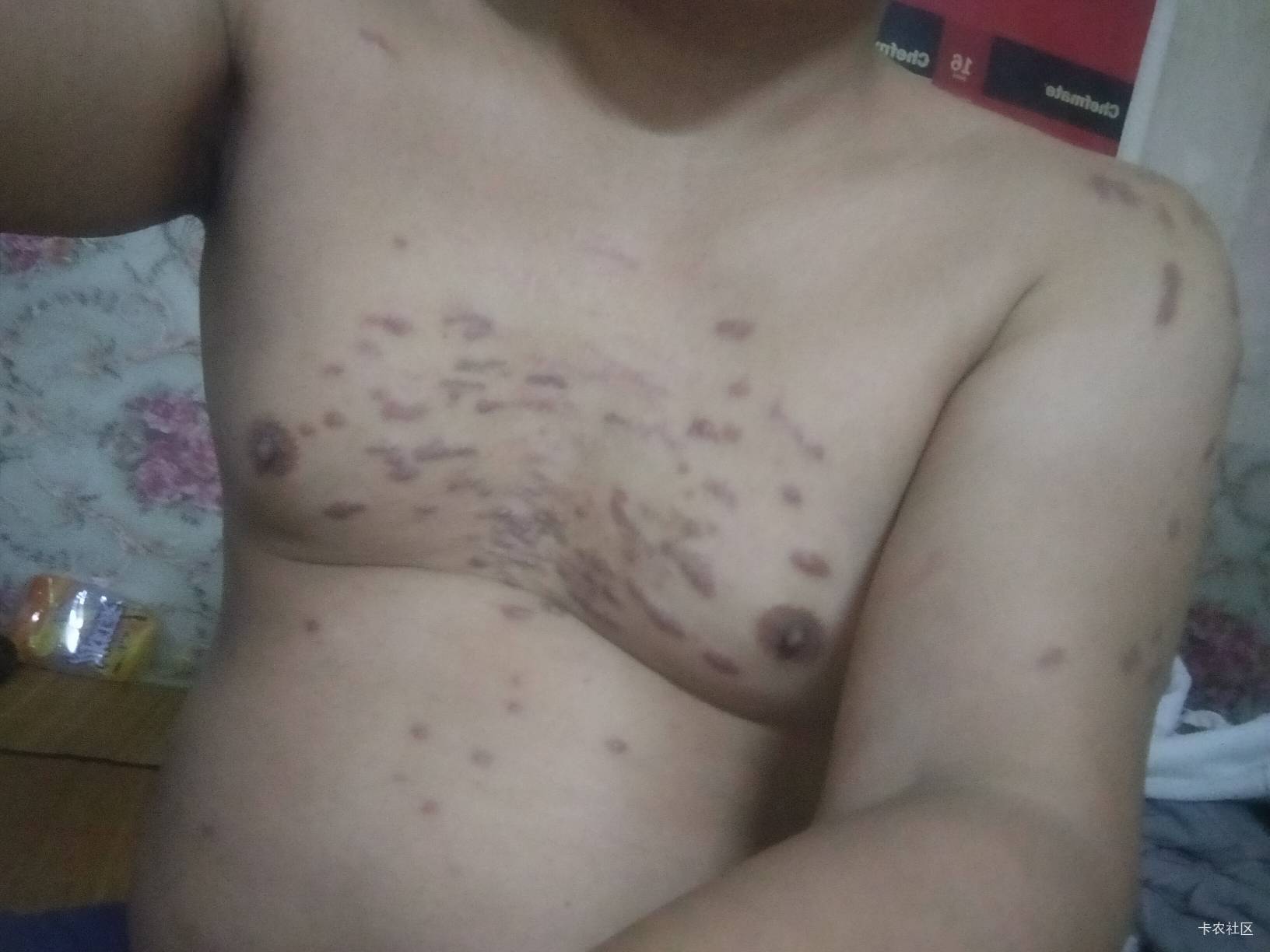 老哥们，咋天去见女网友，他看见我身上这个吓哭了

15 / 作者:卡农第一yy仔 / 