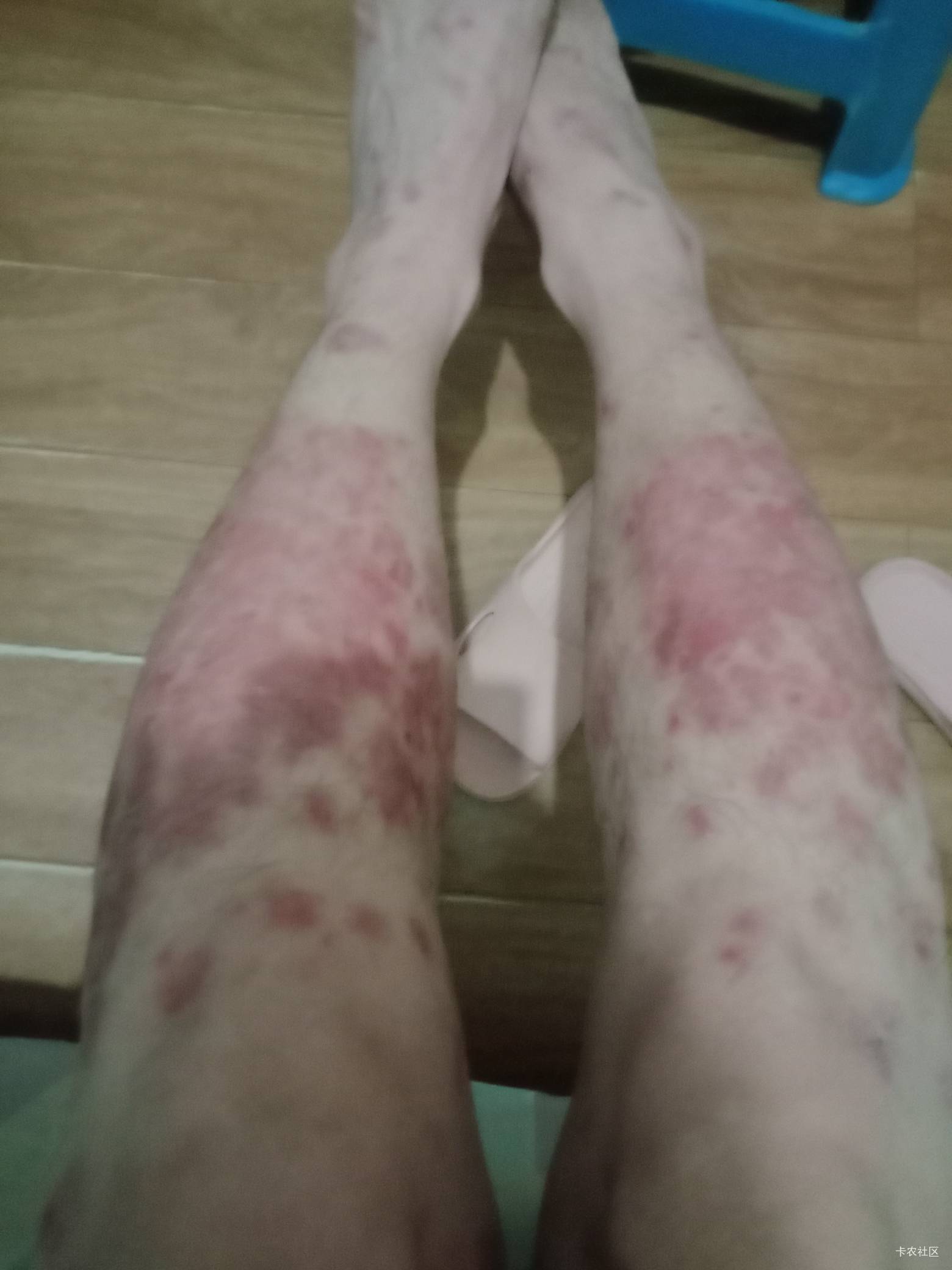 老哥们，疼。玛德老板工资从10月推到现在不发。
一开始是图一，现在图二。
走路都困难57 / 作者:mmmmkbh / 