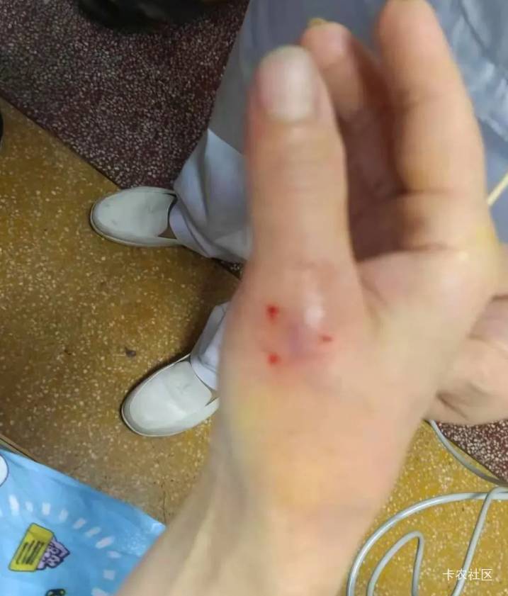 兄弟们他咬我，那不是黄金大泥鳅

59 / 作者:羊肉汤 / 