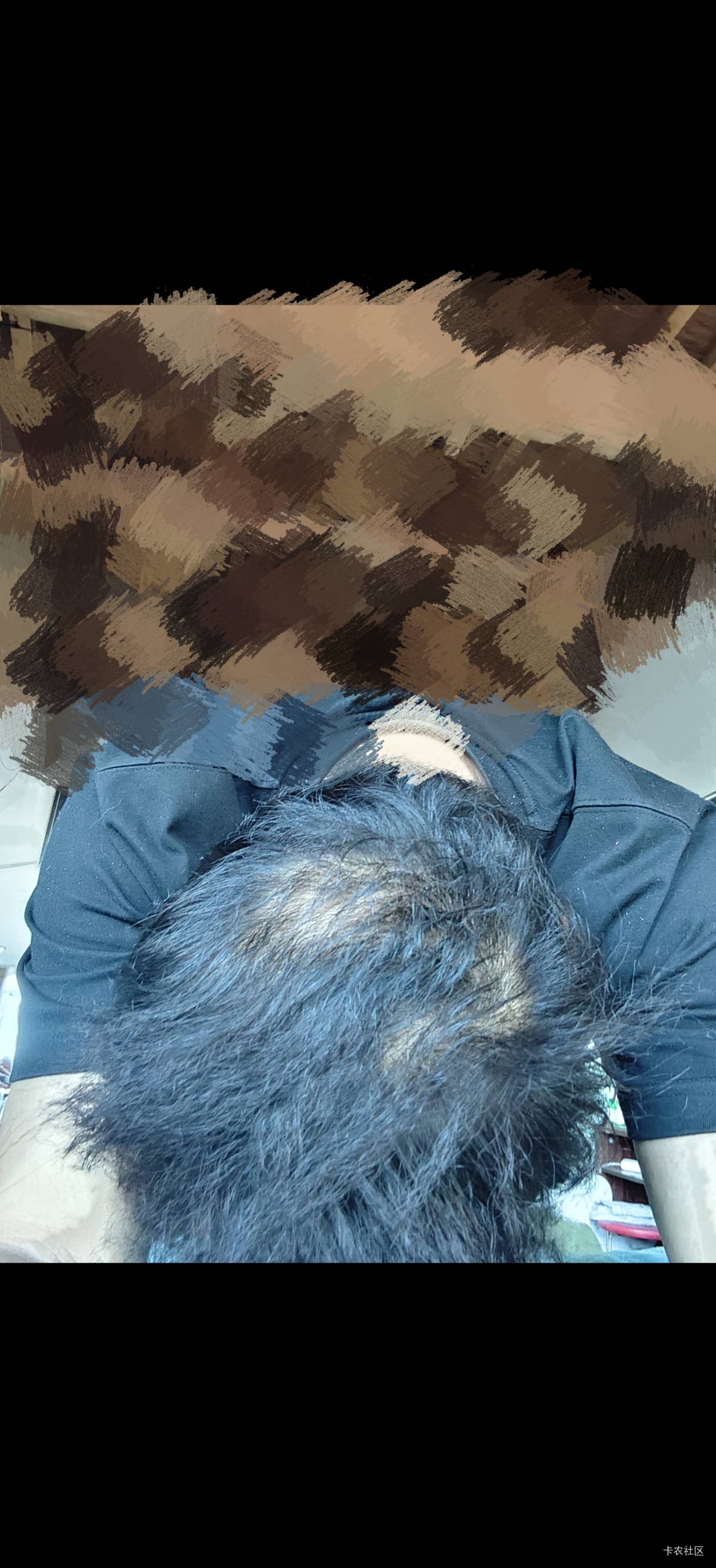这就是卡农，说了吃了两个月秃顶长出来了，一群人说你打广告，一群人说什么那么首富就82 / 作者:一加二 / 