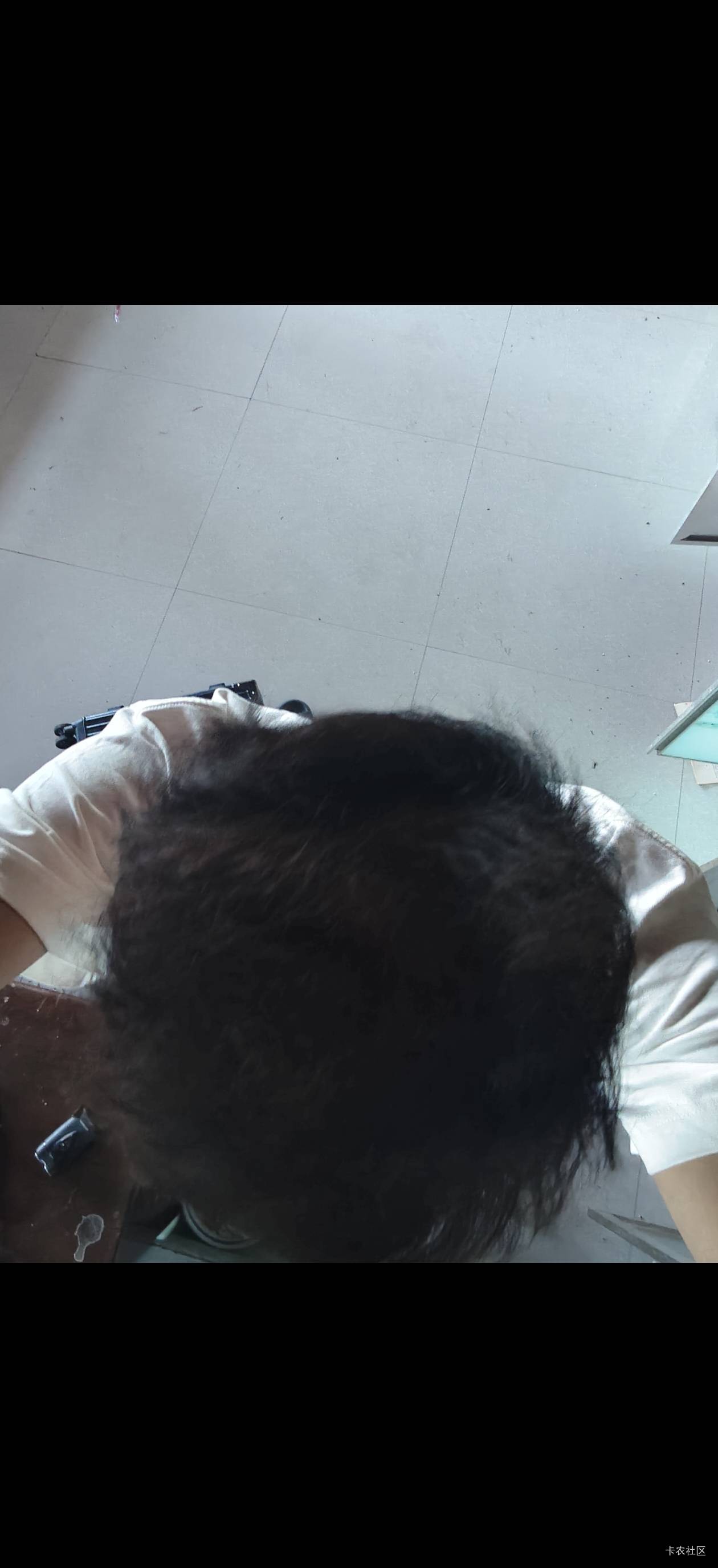 这就是卡农，说了吃了两个月秃顶长出来了，一群人说你打广告，一群人说什么那么首富就37 / 作者:一加二 / 