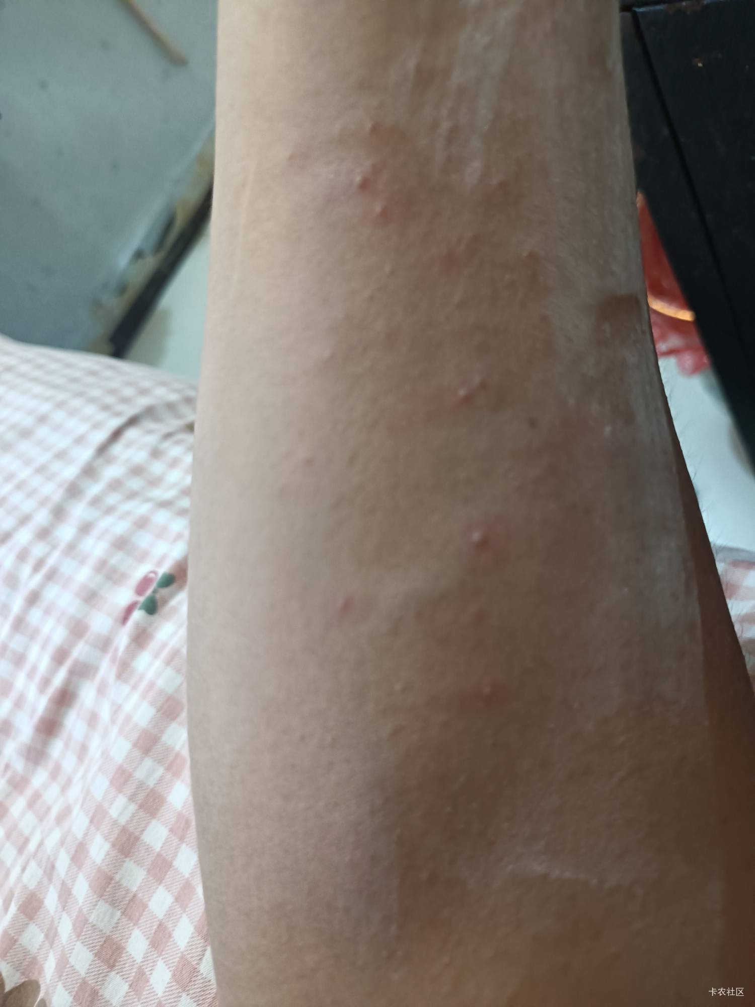 唉，本来明天周日日结那里又要人了，无奈身上热的长痱子了，今天刚搬了空调屋，只能在36 / 作者:生蚝熟了 / 