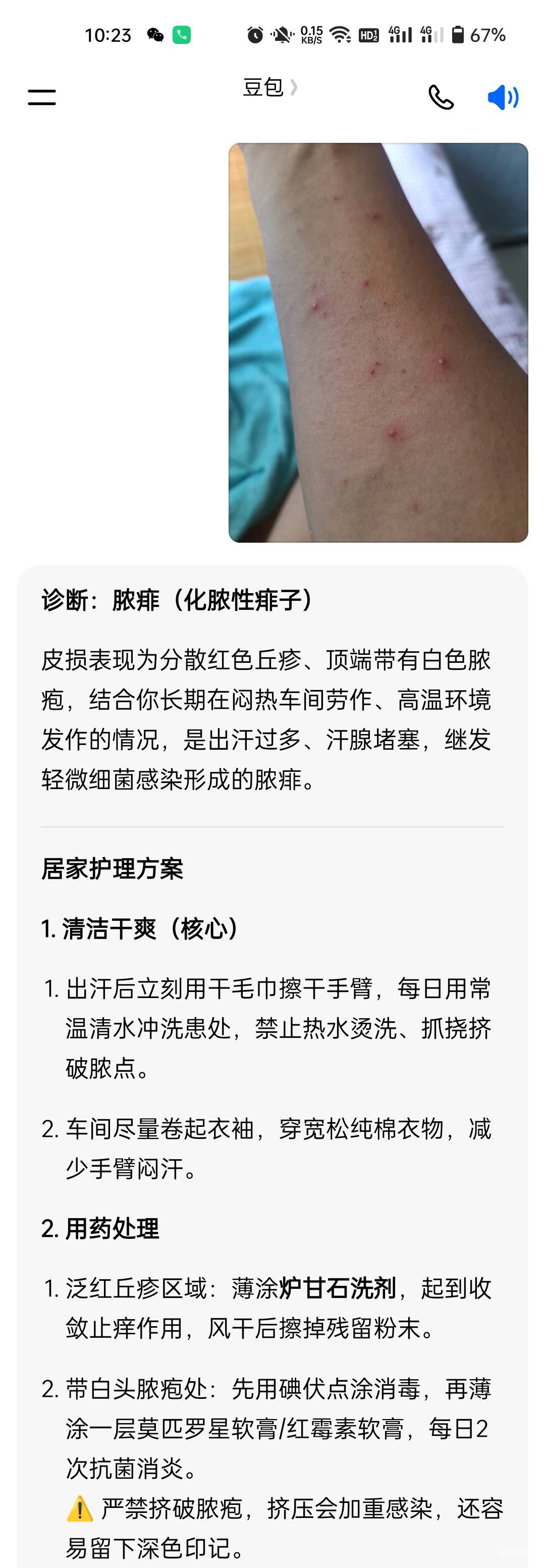 昨天搬进空调房症状好多了，疙瘩也少了，本来是热的闷出来的痱子，不知道的以为是梅毒80 / 作者:生蚝熟了 / 