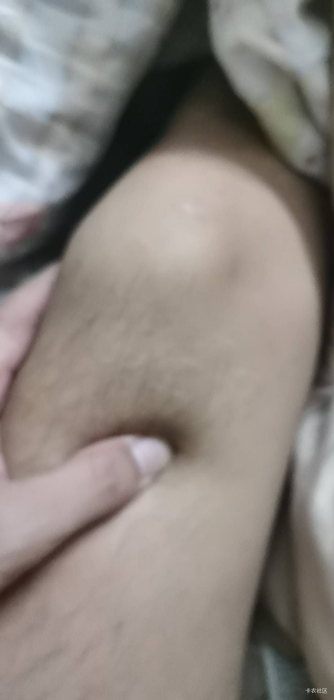 老哥们膝盖这里筋神经一阵阵的疼怎么回事啊 是吹空调吹的吗 今天干了一天活晚上又疼了20 / 作者:梦想当村长 / 