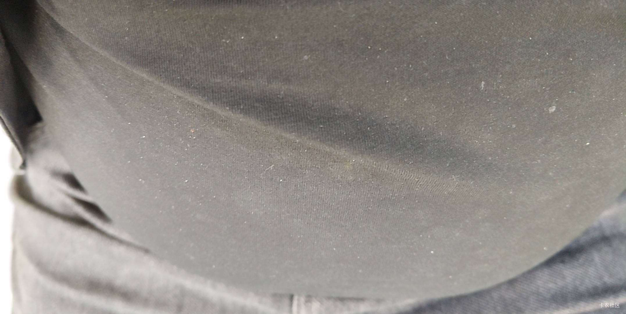 绝望了，五六年了找不到工作，就因为胖，体检过不去，脂肪多，那个转氨酶高300多，减88 / 作者:宁波躺平老哥 / 